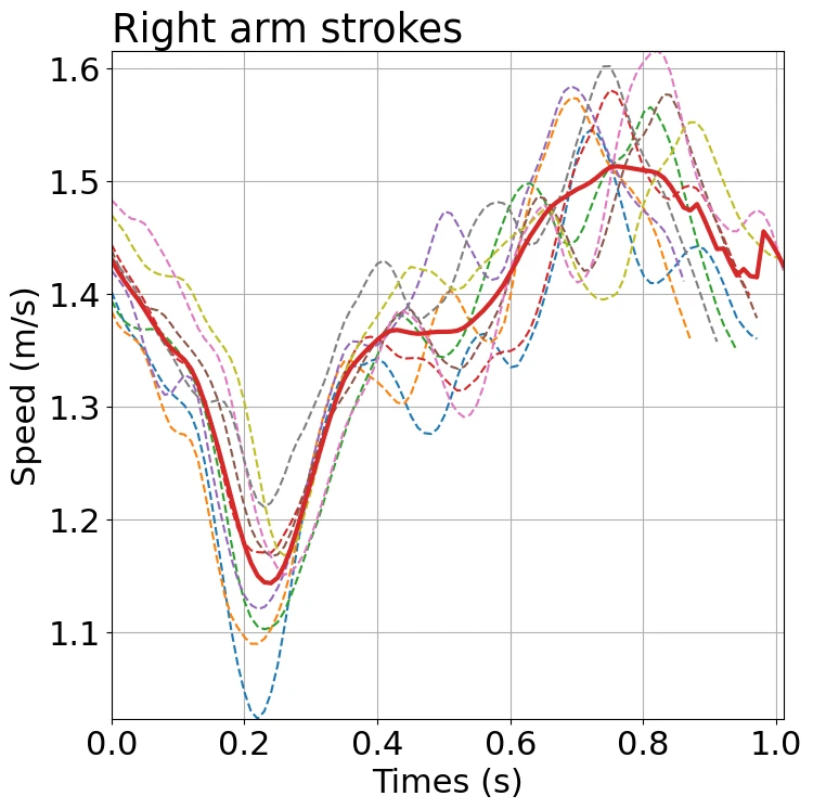 Graph of the speed changes (right arm)